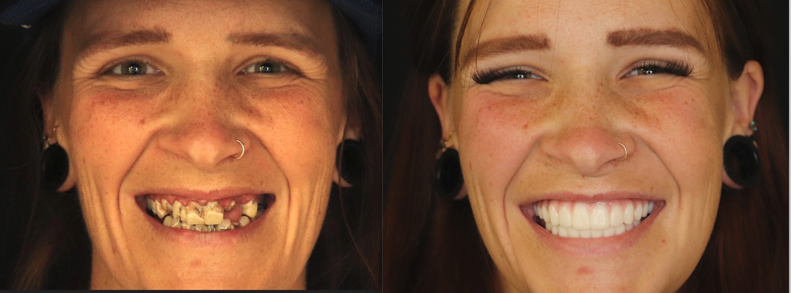 “I used to be happy during covid cause we would wear masks 24/7. Now I hate them!” - Stacey